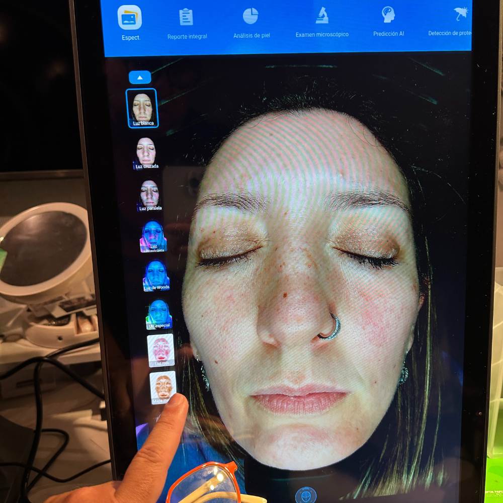 X5 PRO DETECTION MISTIK