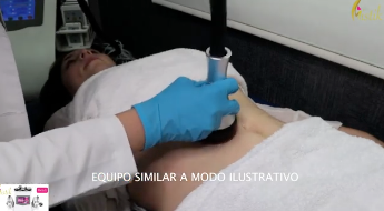 Cargar video: 