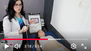 Cargar video: 