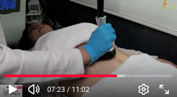 Cargar video: 